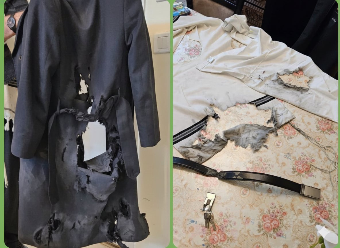 בגדיו הקרועים של אנשין | חדשות העיר בי"ש