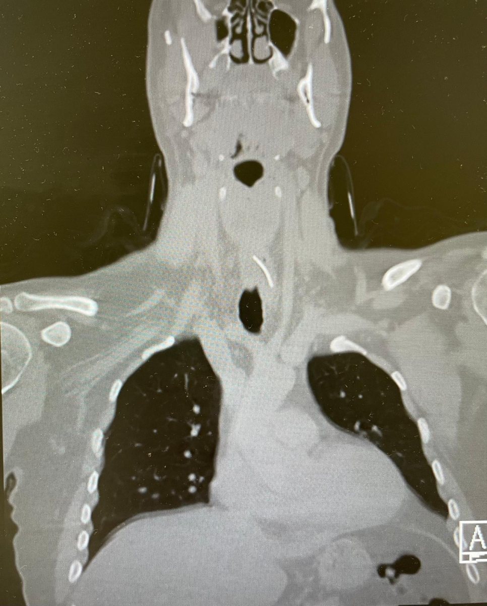 נראה אתכם מוצאים את הברזל ברנטגן | דוברות שערי צדק
