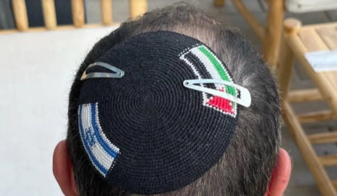 הכיפה השלמה על ראשו של סינקלר | צילום: אלכס סינקלר