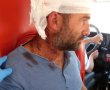 20 דקות בלבד מבאר שבע: פיגוע וניסיון רצח בישוב מעון