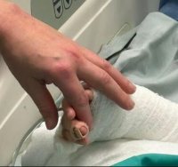 הילד נכווה קשות | צילום: הדסה עין כרם